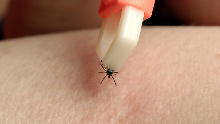 Bildnummer: 51941874  Datum: 22.05.2005  Copyright: imago/Niehoff
Zecke (Ixodida) wird entfernt, Objekte , Tiere; 2007, Symbolfoto, Zecken, Zeckenzange, Zeckenzangen, Zangen, Zangen, Entfernung, entfernen, Zeckenentfernung, Beseitigen, Zeckenbeseitigung, Zeckenbiss, Zeckenbisse, Insekt, Insekten, Studioaufnahme , Wirbellose; , quer, Kbdig, Einzelbild, Deutschland,  , Gesundheit