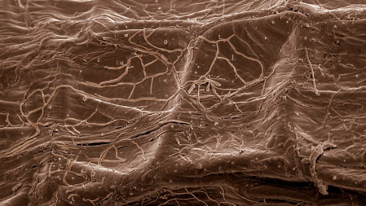Scanning Electron Micrograph SEM: Mycorrhiza fungus in plant root . Magnification x 700 if printed A4, 29.7 cm wide. David Spears Last Refuge / ardea.com. PUBLICATIONxINxGERxSUIxAUTxONLY Copyright: LastxRefuge 10877028