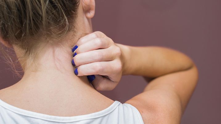 Great concept of allergy and skin diseases, young woman scratching herself.