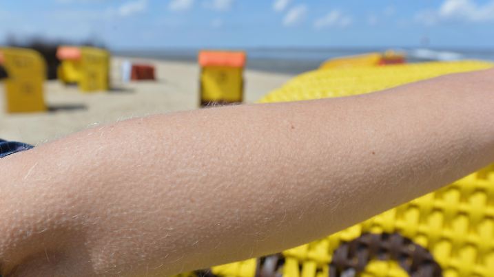 Gänsehaut auf dem Arm hat Inga aus Geesthacht am 14.05.2013 trotz Sonne am Strand von Cuxhaven (Niedersachsen), da der Wind doch noch recht frisch ist. Foto: Carmen Jaspersen/dpa | Verwendung weltweit